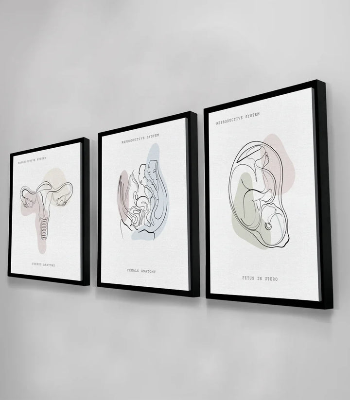 Triptyque Womb Essence encadrement noir moderne bureau Massinart