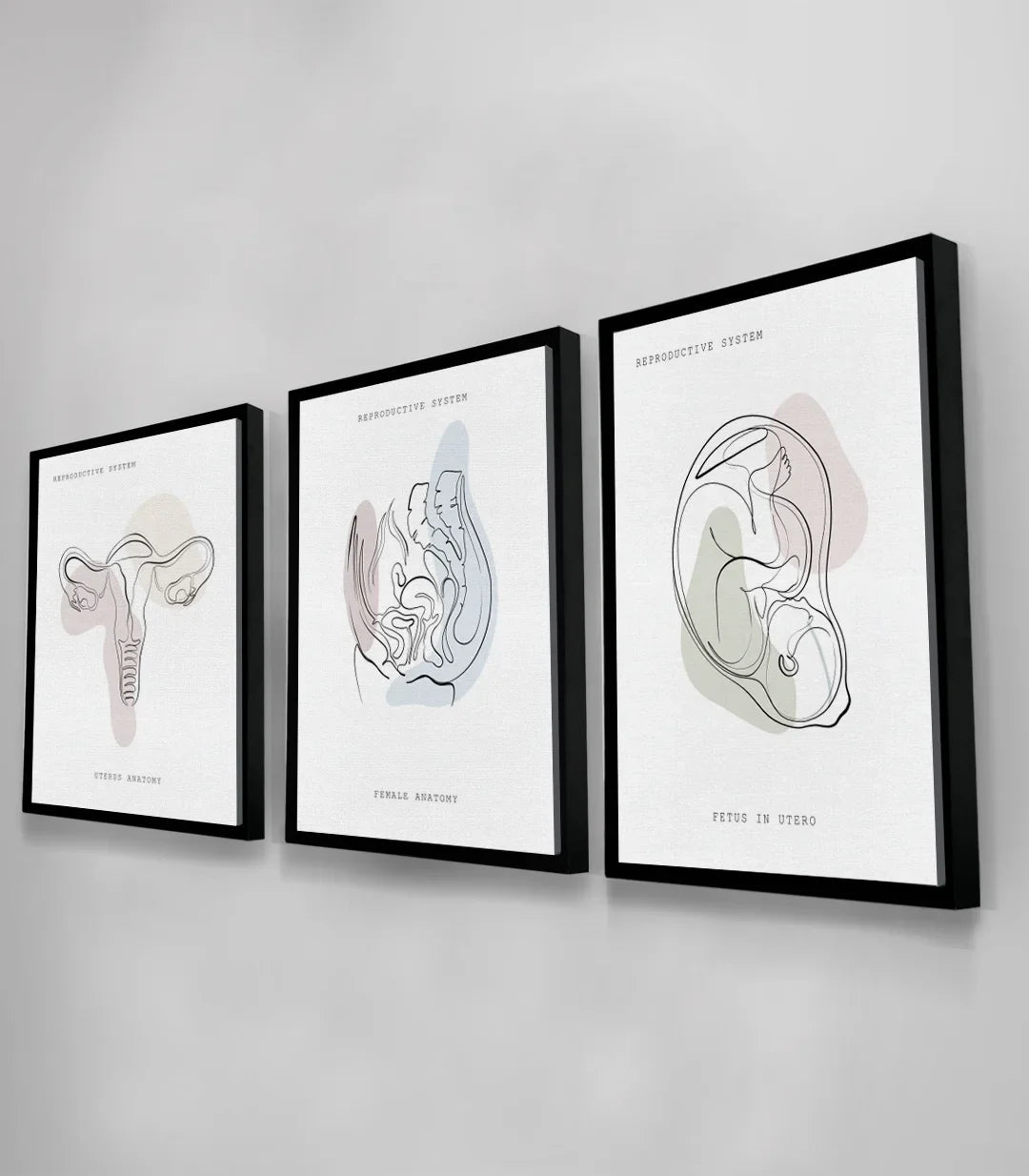 Triptyque Womb Essence encadrement noir moderne bureau Massinart