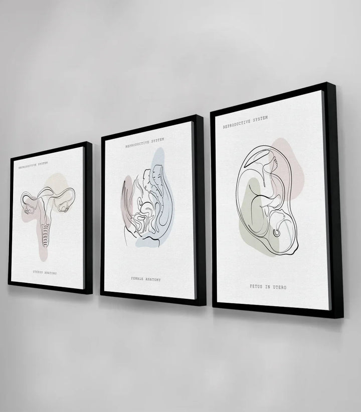 Triptyque Womb Essence encadrement noir moderne bureau Massinart